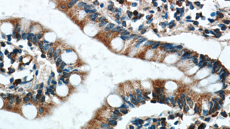 Immunohistochemical of paraffin-embedded human small intestine using Catalog No:110915(MOGS antibody) at dilution of 1:100 (under 40x lens)