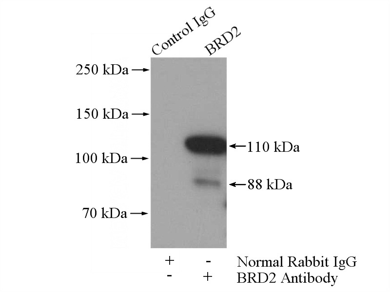 IP Result of anti-BRD2 (IP:Catalog No:117227, 4ug; Detection:Catalog No:117227 1:300) with HeLa cells lysate 1200ug.