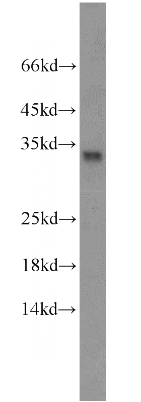 Jurkat cells were subjected to SDS PAGE followed by western blot with Catalog No:111796(ING4-specific antibody) at dilution of 1:500