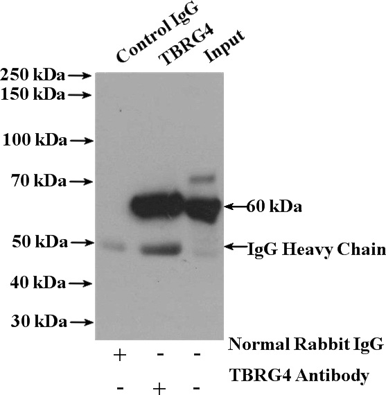 IP Result of anti-TBRG4 (IP:Catalog No:115885, 4ug; Detection:Catalog No:115885 1:500) with HepG2 cells lysate 1600ug.