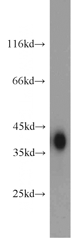 mouse kidney tissue were subjected to SDS PAGE followed by western blot with Catalog No:107977(ALDOB antibody) at dilution of 1:4000