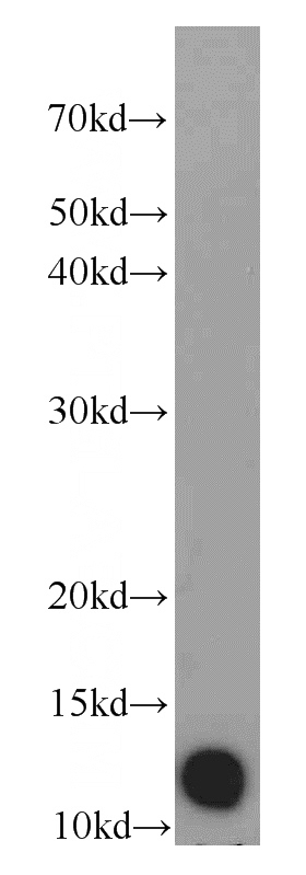 A549 cells were subjected to SDS PAGE followed by western blot with Catalog No:109943(DIO1 antibody) at dilution of 1:1000