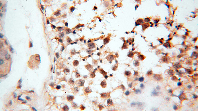 Immunohistochemical of paraffin-embedded human testis using Catalog No:108856(CARD6 antibody) at dilution of 1:100 (under 40x lens)
