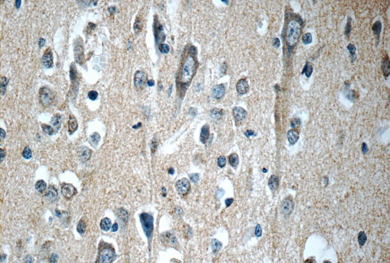 Immunohistochemistry of paraffin-embedded human brain tissue slide using Catalog No:108020(APLP1 Antibody) at dilution of 1:50 (under 40x lens)