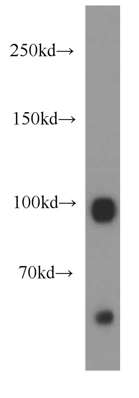 mouse brain tissue were subjected to SDS PAGE followed by western blot with Catalog No:111250(GUCY2D antibody) at dilution of 1:300