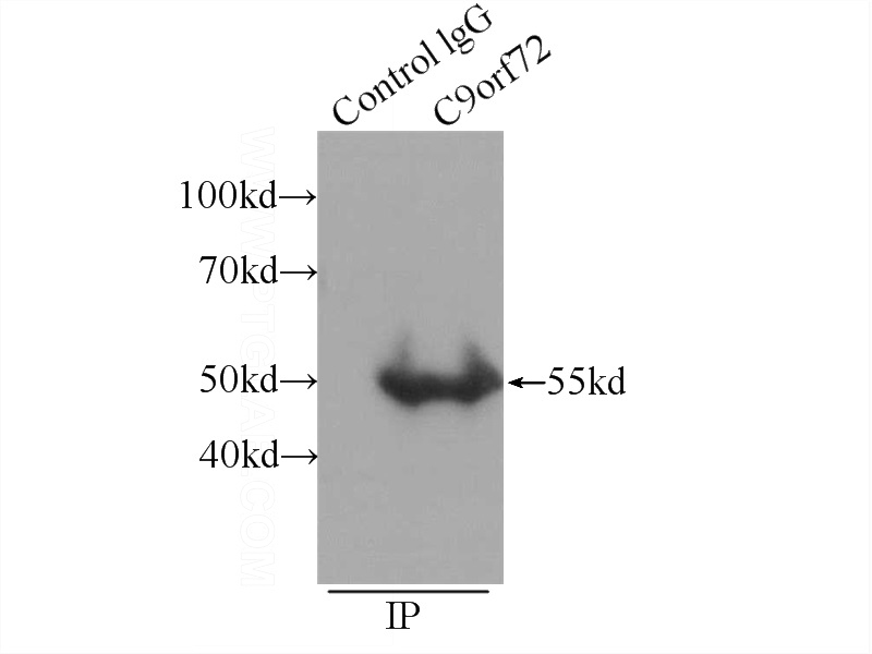 IP Result of anti-C9orf72 (IP:Catalog No:107029, 4ug; Detection:Catalog No:107029 1:1000) with C6 cells lysate 1320ug.