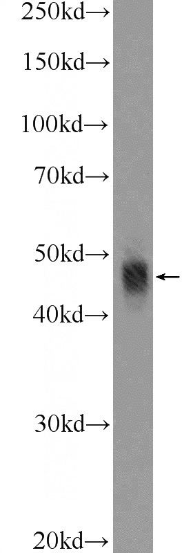 mouse colon tissue were subjected to SDS PAGE followed by western blot with Catalog No:108027(APOBEC3G Antibody) at dilution of 1:100