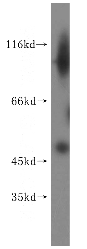 HEK-293 cells were subjected to SDS PAGE followed by western blot with Catalog No:113978(PNMAL1 antibody) at dilution of 1:500