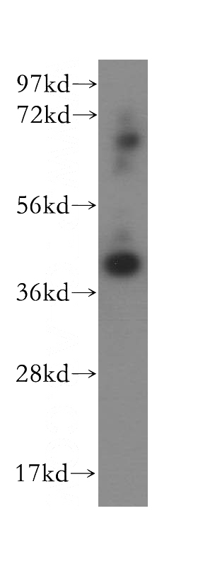 HepG2 cells were subjected to SDS PAGE followed by western blot with Catalog No:108018(AMZ2 antibody) at dilution of 1:1000
