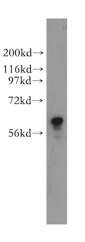 MCF7 cells were subjected to SDS PAGE followed by western blot with Catalog No:116403(TROVE2 antibody) at dilution of 1:500