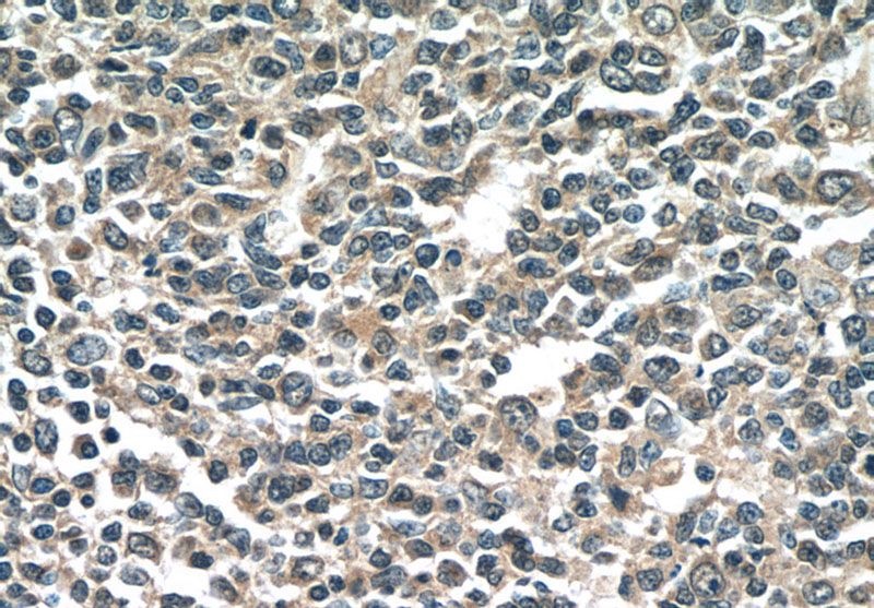Immunohistochemistry of paraffin-embedded human tonsillitis tissue slide using Catalog No:107333(NINJ2 Antibody) at dilution of 1:50 (under 40x lens)