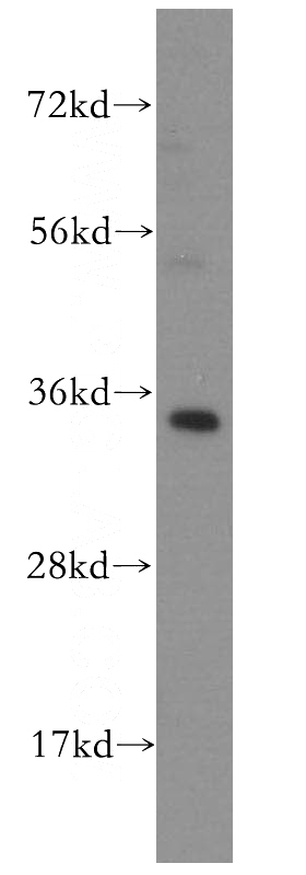 human liver tissue were subjected to SDS PAGE followed by western blot with Catalog No:112808(MRPL1 antibody) at dilution of 1:1000