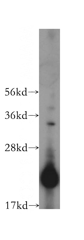 Jurkat cells were subjected to SDS PAGE followed by western blot with Catalog No:109205(CHAC2 antibody) at dilution of 1:500