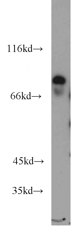 mouse brain tissue were subjected to SDS PAGE followed by western blot with Catalog No:111968(KCNJ1 antibody) at dilution of 1:2000