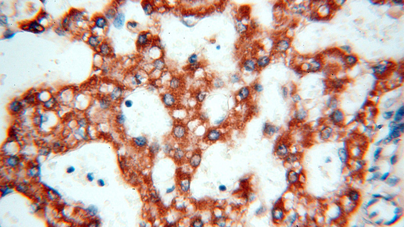 Immunohistochemical of paraffin-embedded human liver using Catalog No:111551(HSD17B8 antibody) at dilution of 1:100 (under 40x lens)