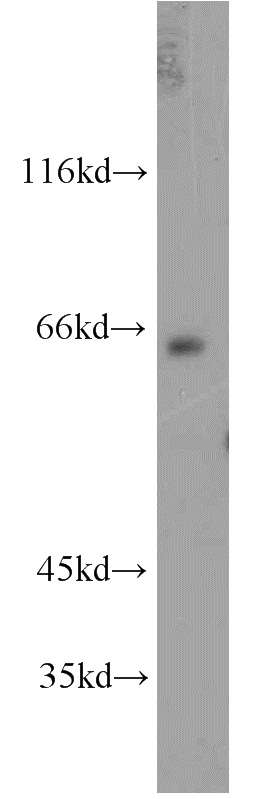 mouse brain tissue were subjected to SDS PAGE followed by western blot with Catalog No:110481(ESX1 antibody) at dilution of 1:800