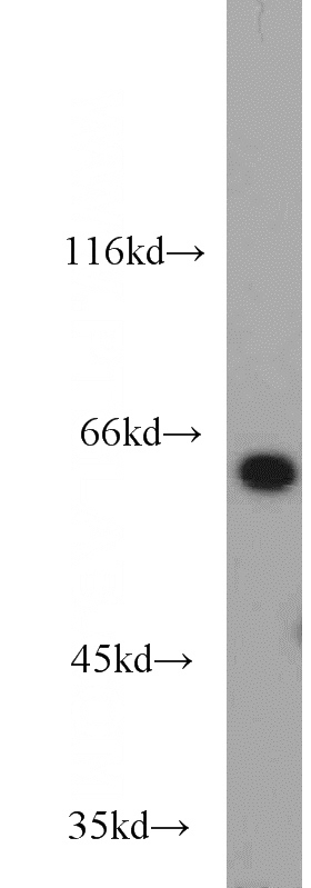 Jurkat cells were subjected to SDS PAGE followed by western blot with Catalog No:112306(LCP1 antibody) at dilution of 1:1000