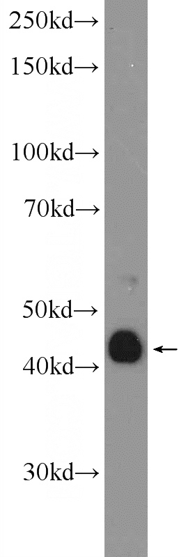 MCF-7 cells were subjected to SDS PAGE followed by western blot with Catalog No:107769(ADAMDEC1 Antibody) at dilution of 1:300
