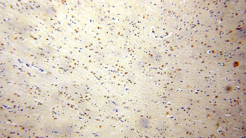 Immunohistochemical of paraffin-embedded human brain using Catalog No:110575(FAM160B2 antibody) at dilution of 1:100 (under 10x lens)