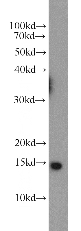 mouse liver tissue were subjected to SDS PAGE followed by western blot with Catalog No:113083(NDUFS5 antibody) at dilution of 1:800