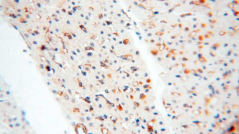 Immunohistochemical of paraffin-embedded human heart using Catalog No:111158(PCDGF,GRN antibody) at dilution of 1:50 (under 40x lens)