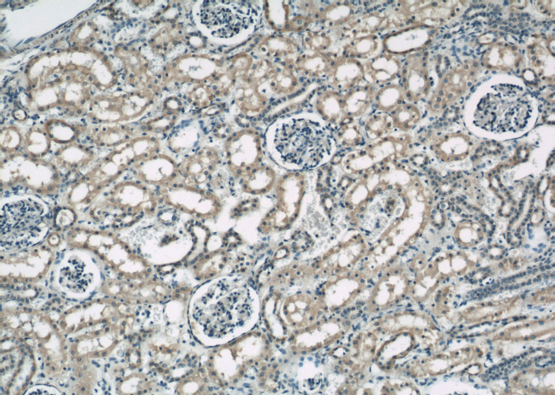 Immunohistochemical of paraffin-embedded human kidney using Catalog No:114951(RYK antibody) at dilution of 1:50 (under 10x lens)