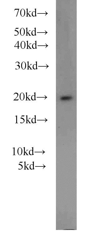 mouse brain tissue were subjected to SDS PAGE followed by western blot with Catalog No:108245(ARF3 antibody) at dilution of 1:1000