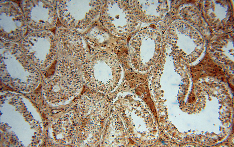 Immunohistochemical of paraffin-embedded human testis using Catalog No:112521(METTL6 antibody) at dilution of 1:50 (under 10x lens)