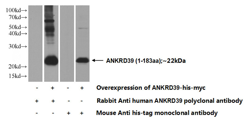 Transfected HEK-293 cells were subjected to SDS PAGE followed by western blot with Catalog No:108076(ANKRD39 Antibody) at dilution of 1:1000