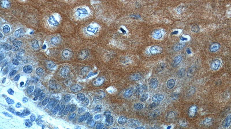 Immunohistochemistry of paraffin-embedded human oesophagus tissue slide using Catalog No:112169(LCE1A Antibody) at dilution of 1:50 (under 40x lens)