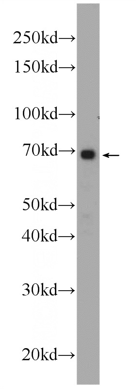HeLa cells were subjected to SDS PAGE followed by western blot with Catalog No:108079(ANKRD53 Antibody) at dilution of 1:1000