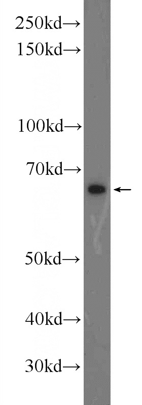 mouse testis tissue were subjected to SDS PAGE followed by western blot with Catalog No:116377(TTC26 Antibody) at dilution of 1:300