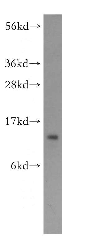 A431 cells were subjected to SDS PAGE followed by western blot with Catalog No:109210(CHCHD1 antibody) at dilution of 1:300