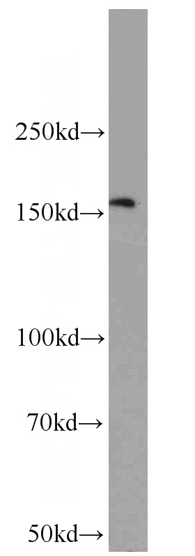mouse thymus tissue were subjected to SDS PAGE followed by western blot with Catalog No:112000(KIF15 antibody) at dilution of 1:500