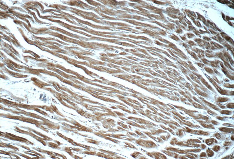 Immunohistochemistry of paraffin-embedded human heart tissue slide using Catalog No:107892(ADRB2 Antibody) at dilution of 1:50 (under 10x lens)