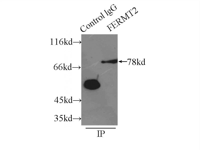 IP Result of anti-FERMT2 (IP:Catalog No:112056, 3ug; Detection:Catalog No:112056 1:1000) with A549 cells lysate 3300ug.