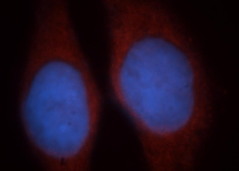 Immunofluorescent analysis of Hela cells, using EIF2B1 antibody Catalog No:110181 at 1:25 dilution and Rhodamine-labeled goat anti-rabbit IgG (red). Blue pseudocolor = DAPI (fluorescent DNA dye).