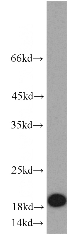 BxPC-3 cells were subjected to SDS PAGE followed by western blot with Catalog No:109131(CD59 antibody) at dilution of 1:600