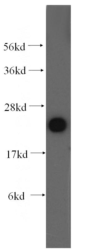 HeLa cells were subjected to SDS PAGE followed by western blot with Catalog No:113767(PDCD6 antibody) at dilution of 1:500