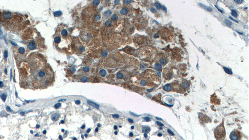 Immunohistochemistry of paraffin-embedded human testis tissue slide using Catalog No:115579(SPocK2 Antibody) at dilution of 1:200 (under 40x lens).