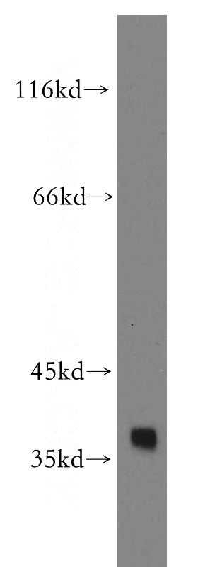 MCF7 cells were subjected to SDS PAGE followed by western blot with Catalog No:107942(AKR1C4 antibody) at dilution of 1:500