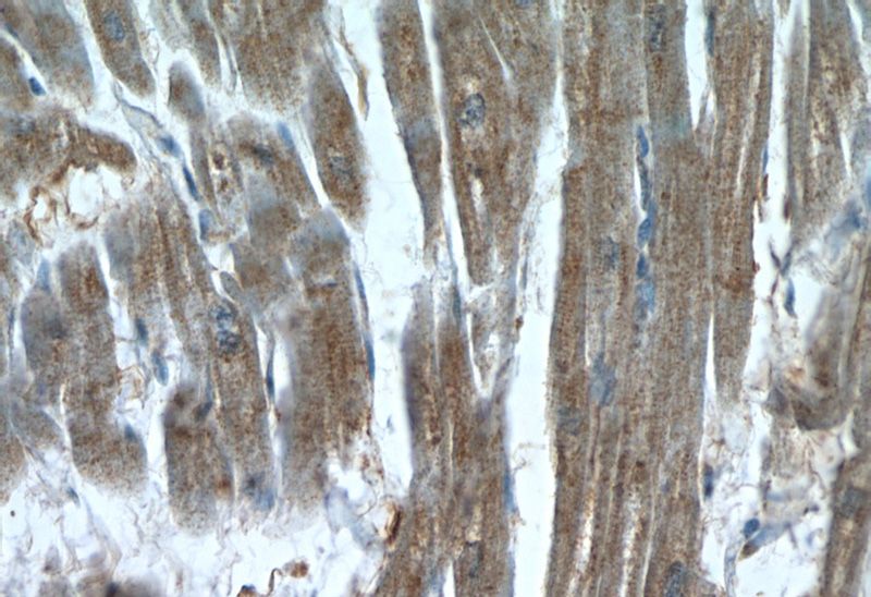 Immunohistochemistry of paraffin-embedded human heart slide using Catalog No:116877(XRN1 Antibody) at dilution of 1:50