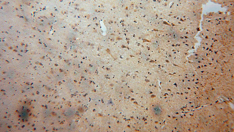 Immunohistochemical of paraffin-embedded human brain using Catalog No:117071(AUH antibody) at dilution of 1:100 (under 10x lens)