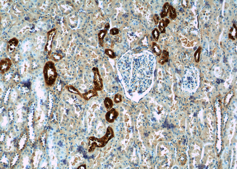 Immunohistochemistry of paraffin-embedded human kidney tissue slide using Catalog No:108815(Calbindin Antibody) at dilution of 1:50 (under 10x lens)