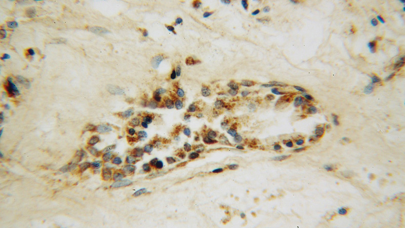 Immunohistochemical of paraffin-embedded human prostate using Catalog No:115721(STK36 antibody) at dilution of 1:50 (under 40x lens)