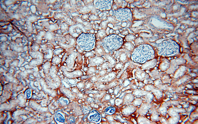 Immunohistochemical of paraffin-embedded human kidney using Catalog No:115945(TNXB antibody) at dilution of 1:50 (under 10x lens)