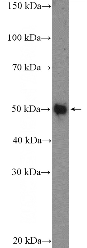 COLO 320 cells were subjected to SDS PAGE followed by western blot with Catalog No:116825(DFNB31 Antibody) at dilution of 1:1000