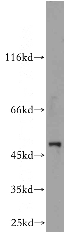 L02 cells were subjected to SDS PAGE followed by western blot with Catalog No:112224(LILRA4 antibody) at dilution of 1:500