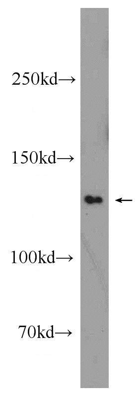 mouse brain tissue were subjected to SDS PAGE followed by western blot with Catalog No:110212(EFTUD1 Antibody) at dilution of 1:1000