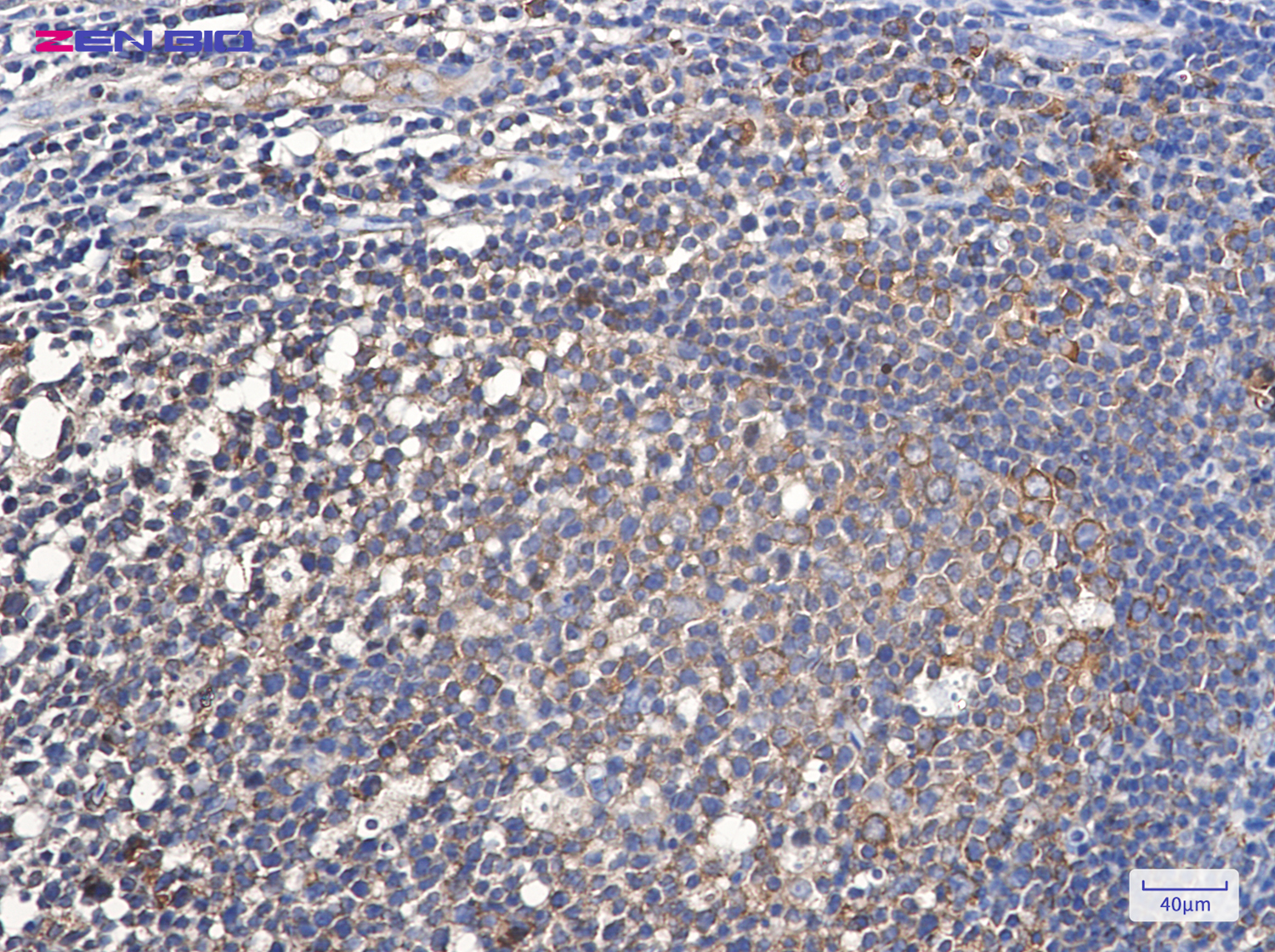 Immunohistochemistry of eEF1A1 in paraffin-embedded Human tonsil using eEF1A1 Rabbit pAb at dilution 1/20